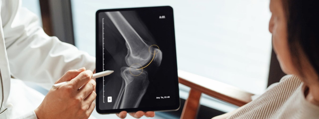Second Medical Opinion